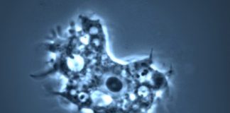 Florida Warns of Rare, Brain-eating Amoeba brain eating amoeba