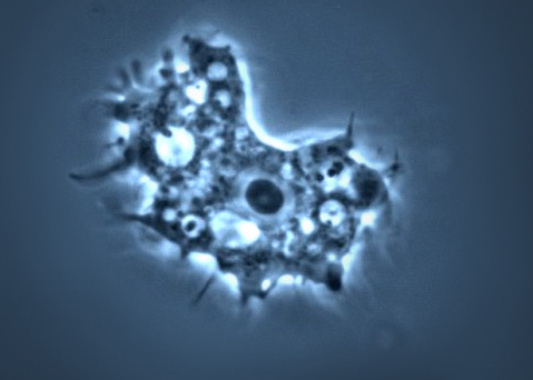 Florida Warns of Rare, Brain-eating Amoeba brain eating amoeba