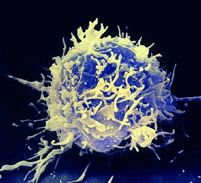 Altering Immune System T-cells Could Potentially Help Fight Cancer t-cell