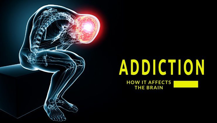 How Does Addiction Affect the Brain? Addiction